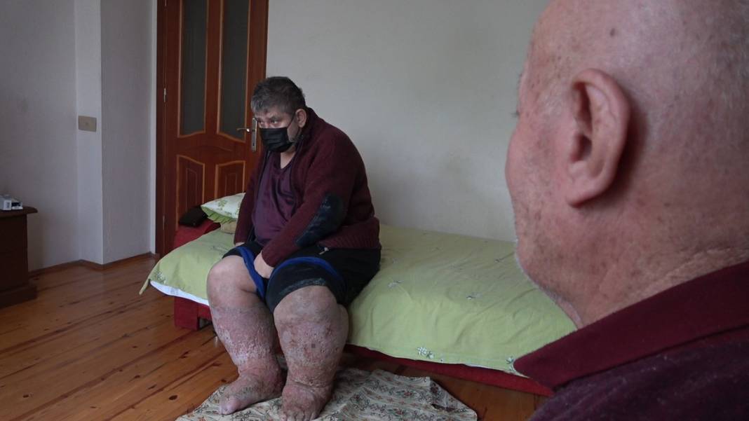 Sivrisinek, hayatının kabusu oldu! Öyle bir hastalığa yakalandı ki doktorlar çaresiz kaldı 10